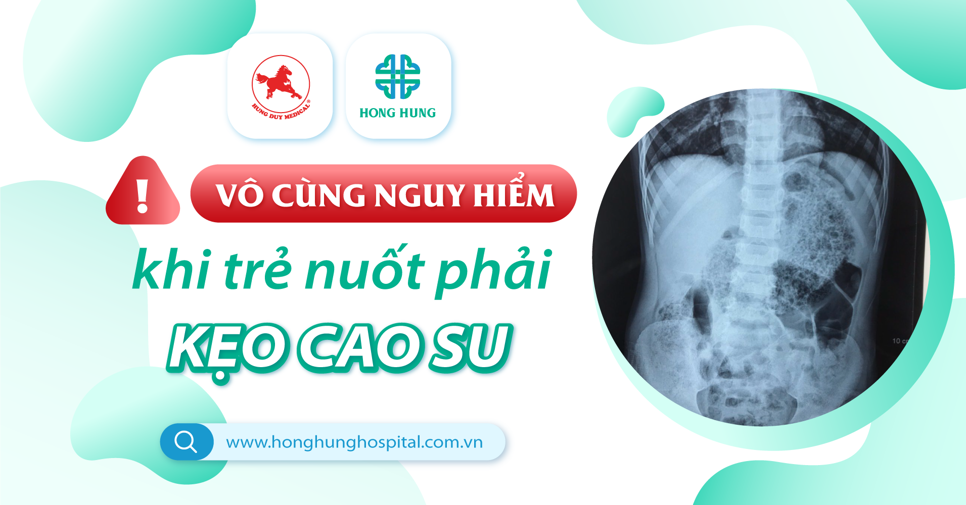 6. Điều trị tắc đường ruột