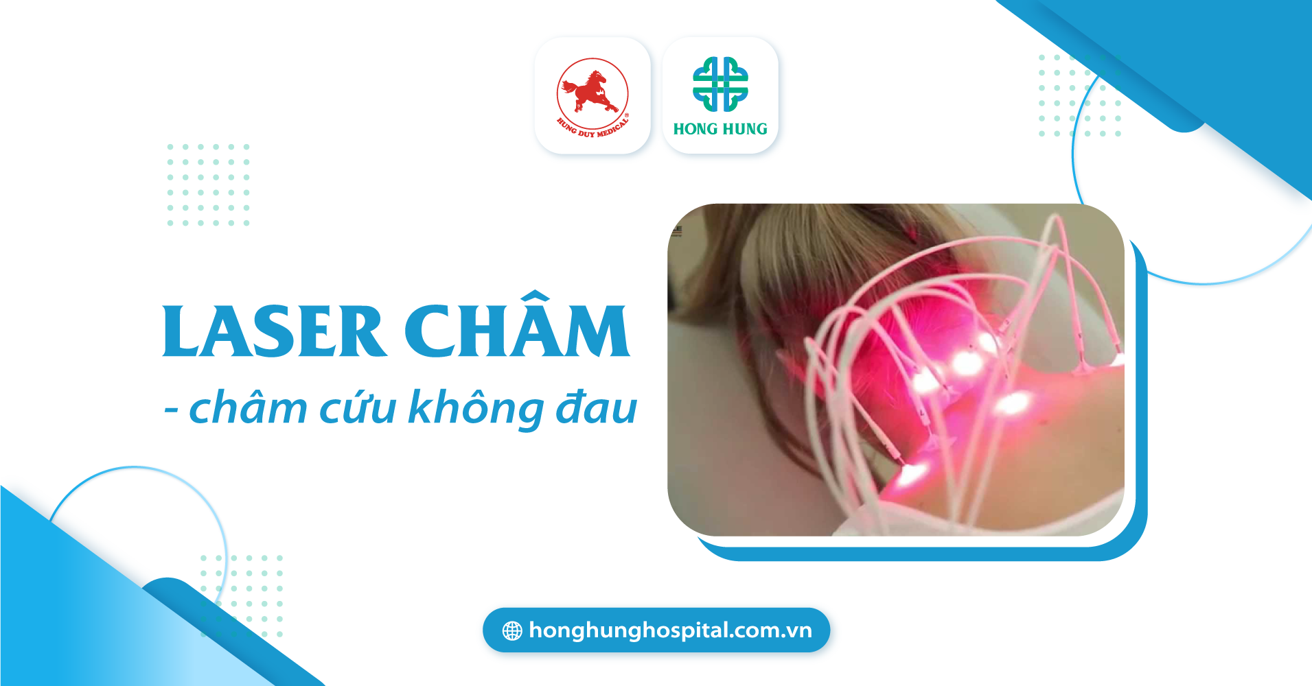 Châm cứu bằng laser là gì?
