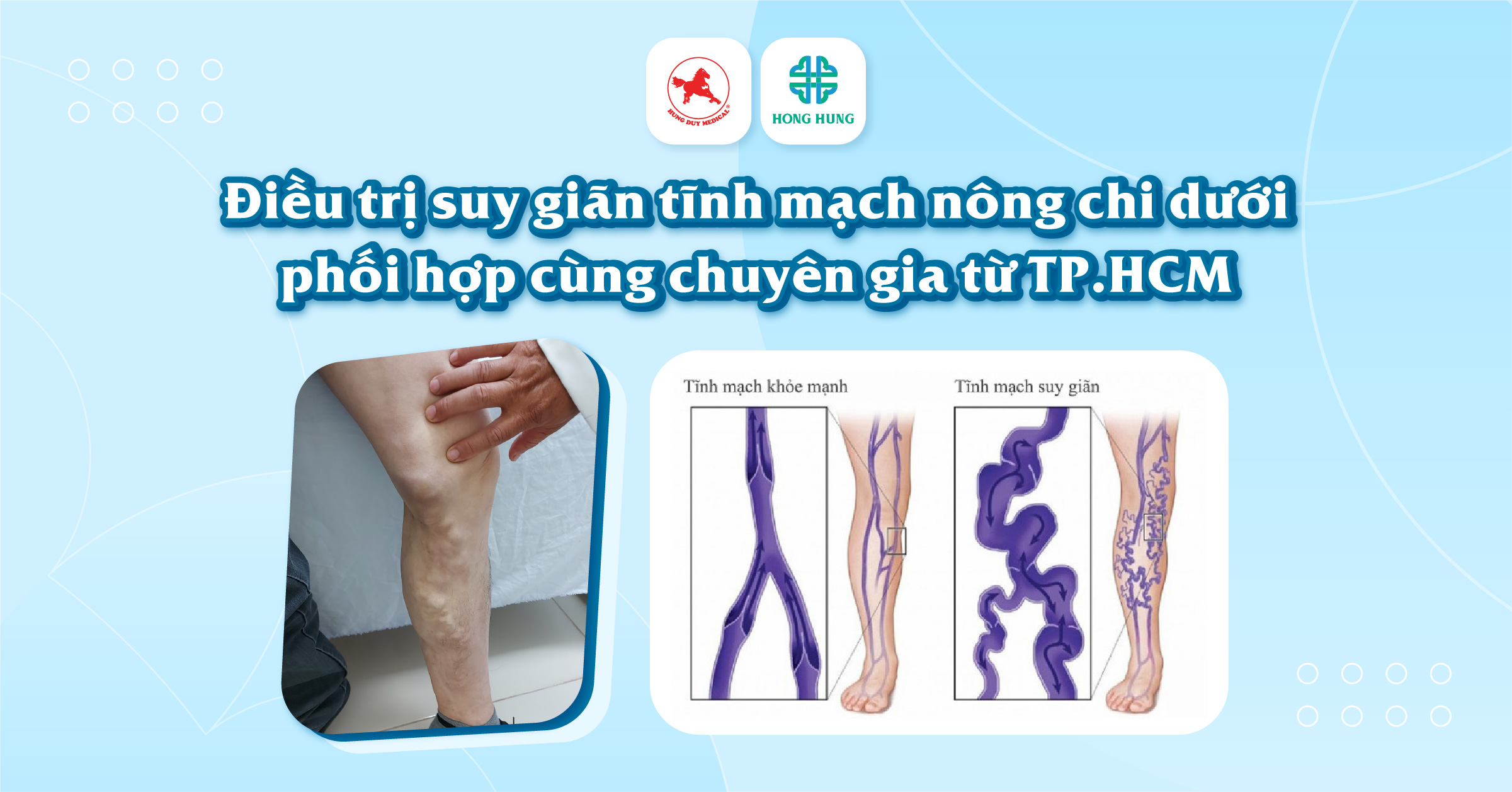 4. Hướng dẫn sử dụng thuốc bổ não dạng tiêm