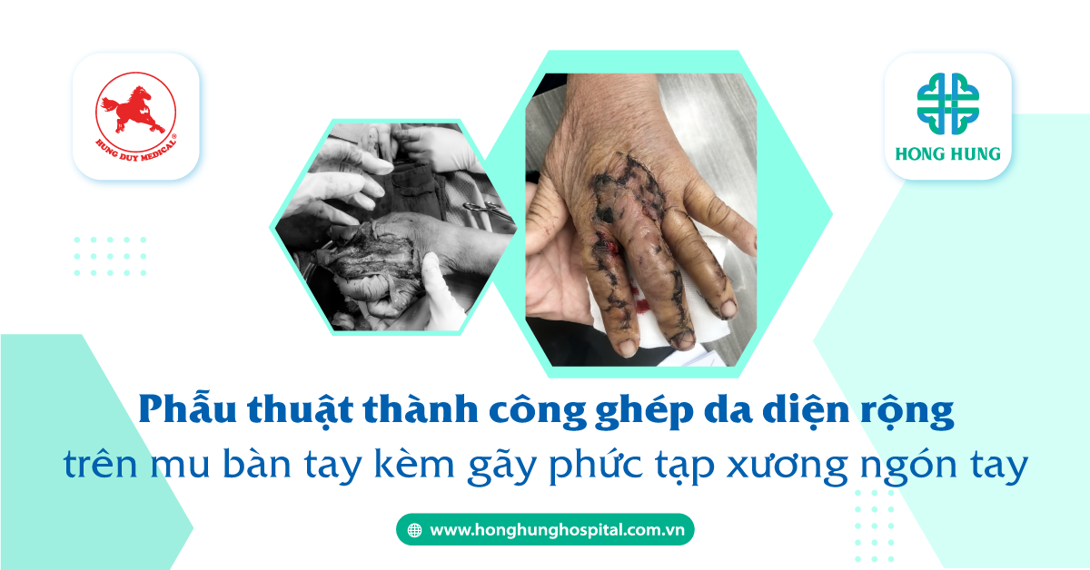 Ai là những người phù hợp để thực hiện phẫu thuật ghép da?
