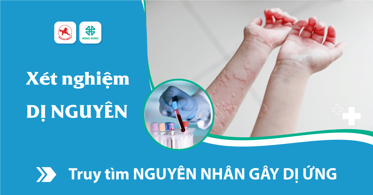 4. Dị nguyên phổ biến và triệu chứng dị ứng