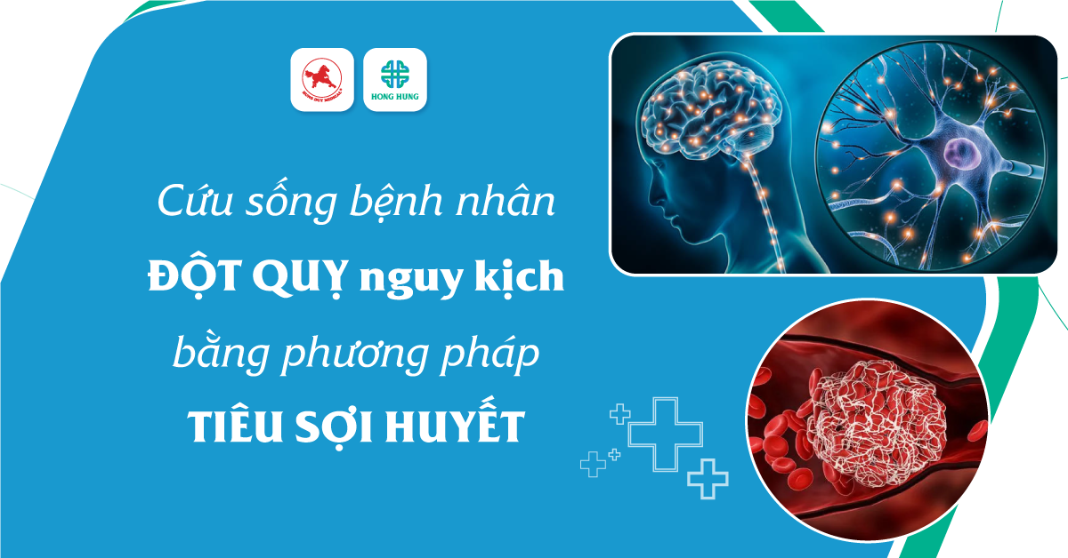 Ưu và nhược điểm của tiêu sợi huyết trong đột quỵ não