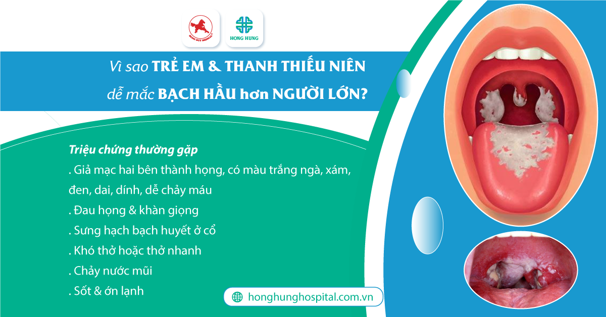 Triệu chứng của người nhiễm bạch hầu