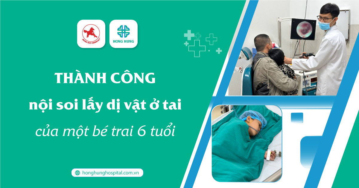 Nội soi thành công dị vật trong tai bé trai 6 tuổi