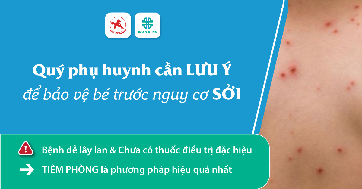 luu-y-de-phong-soi