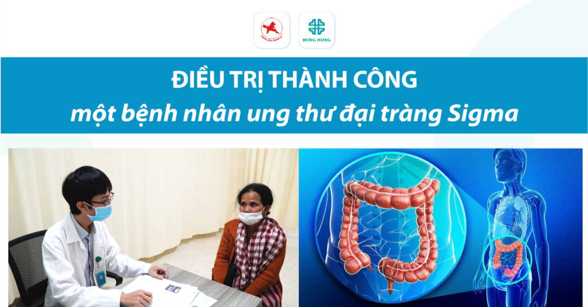 dieu tri thanh cong ung thu dai trang sigma