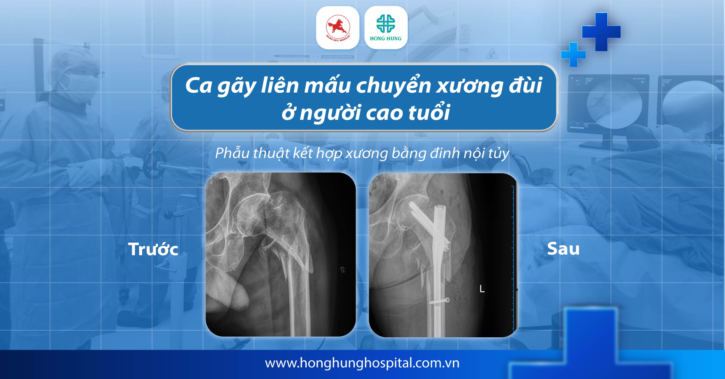 cap cuu chan thuong