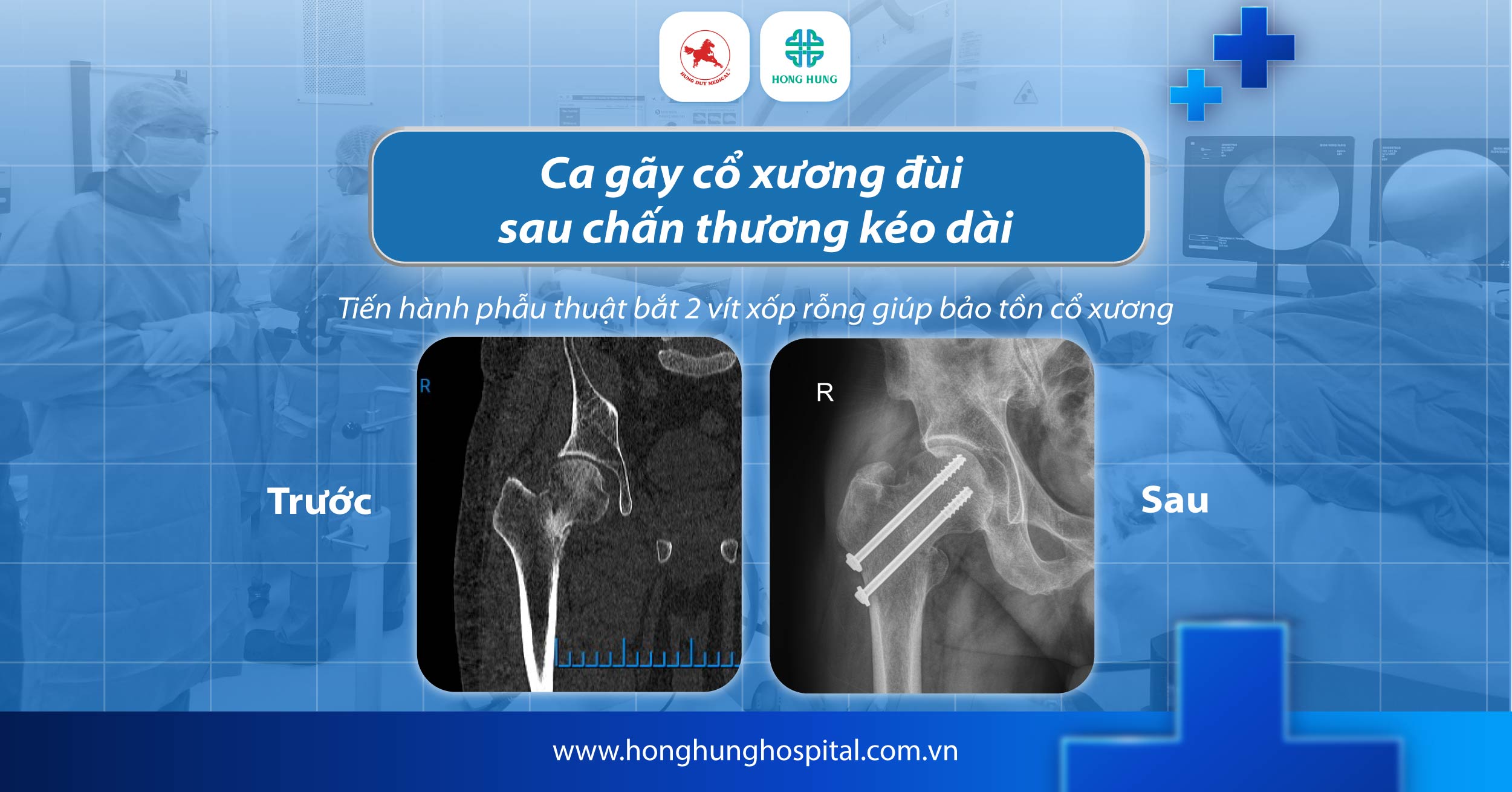 cap cuu chan thuong
