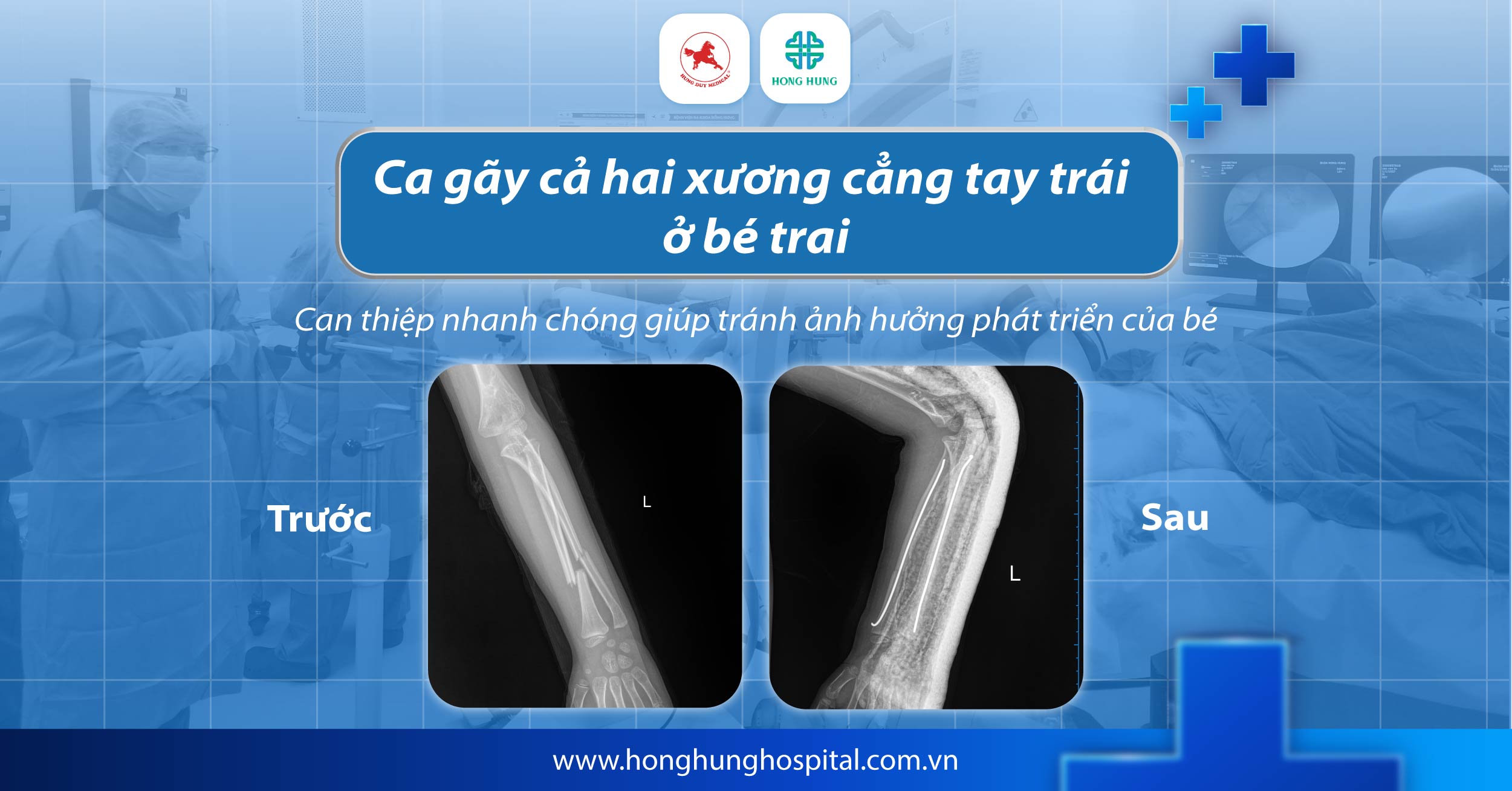 cap cuu chan thuong