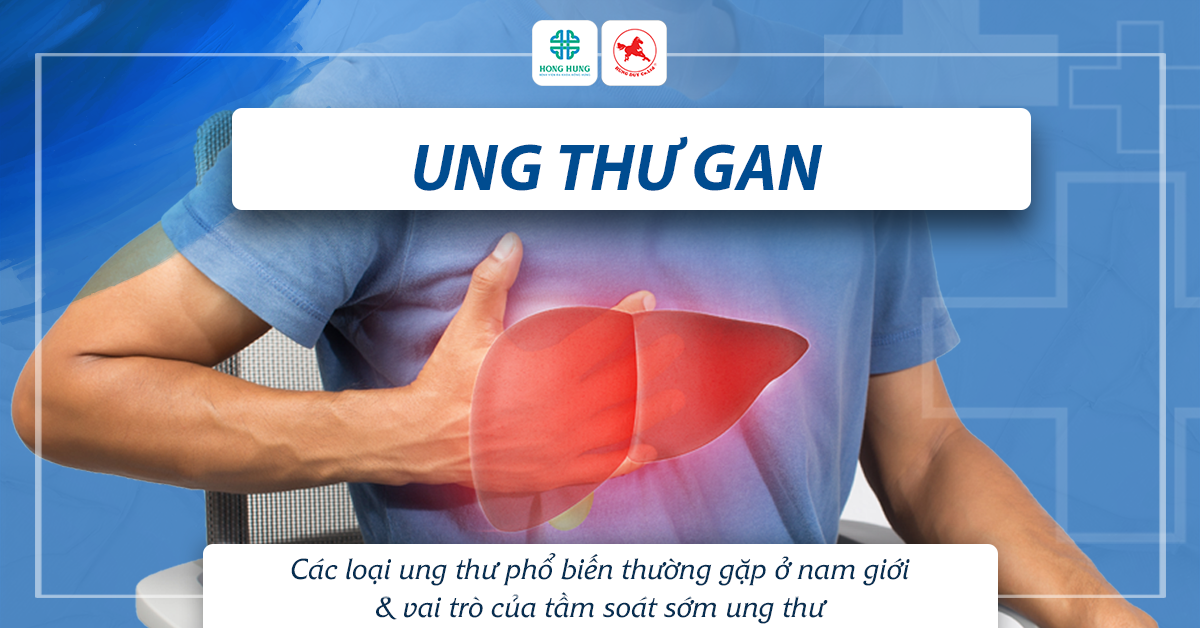 ung thu gan