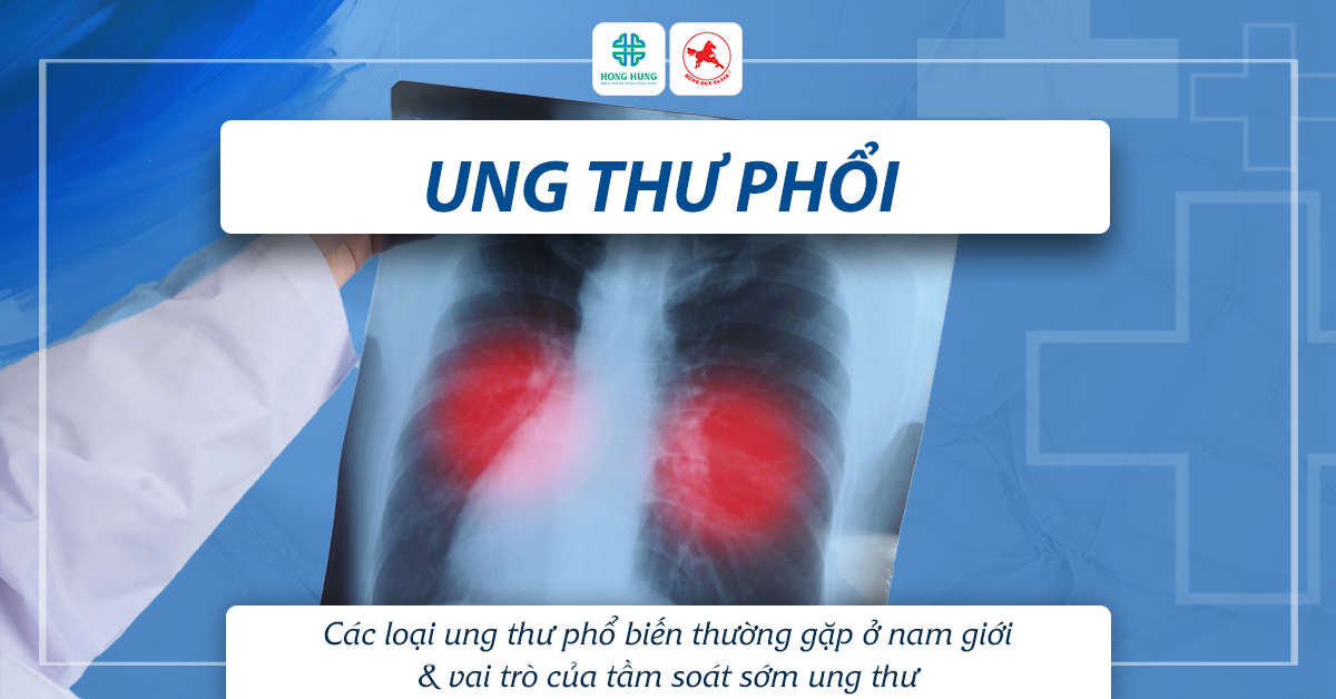 ung thu phoi