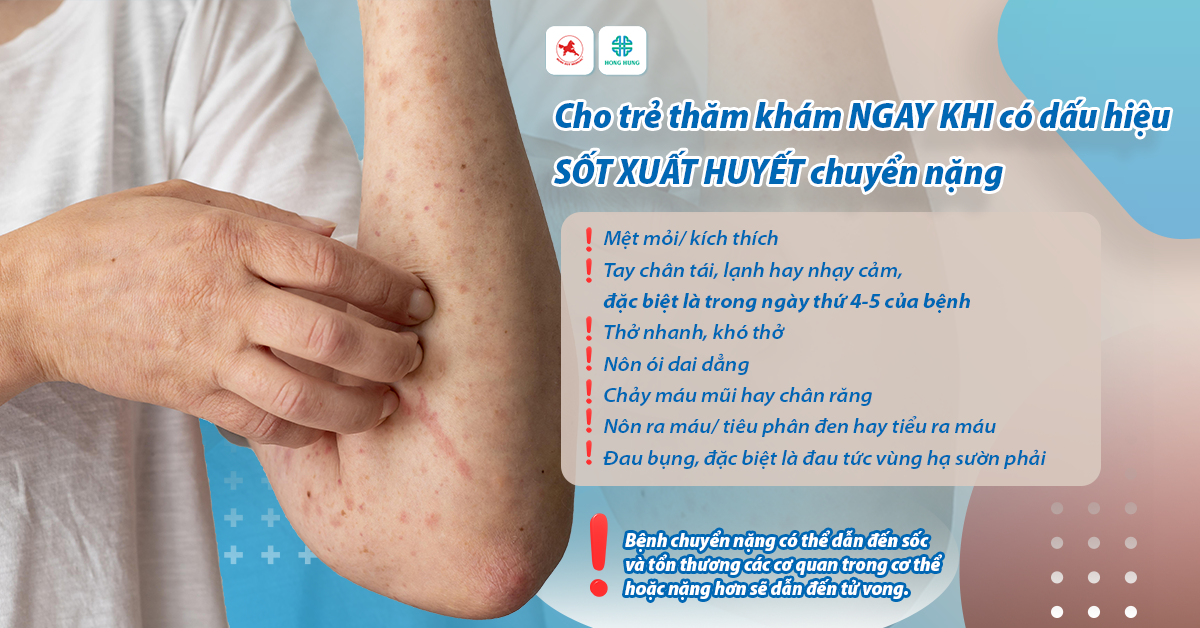 vac-xin sot xuat huyet