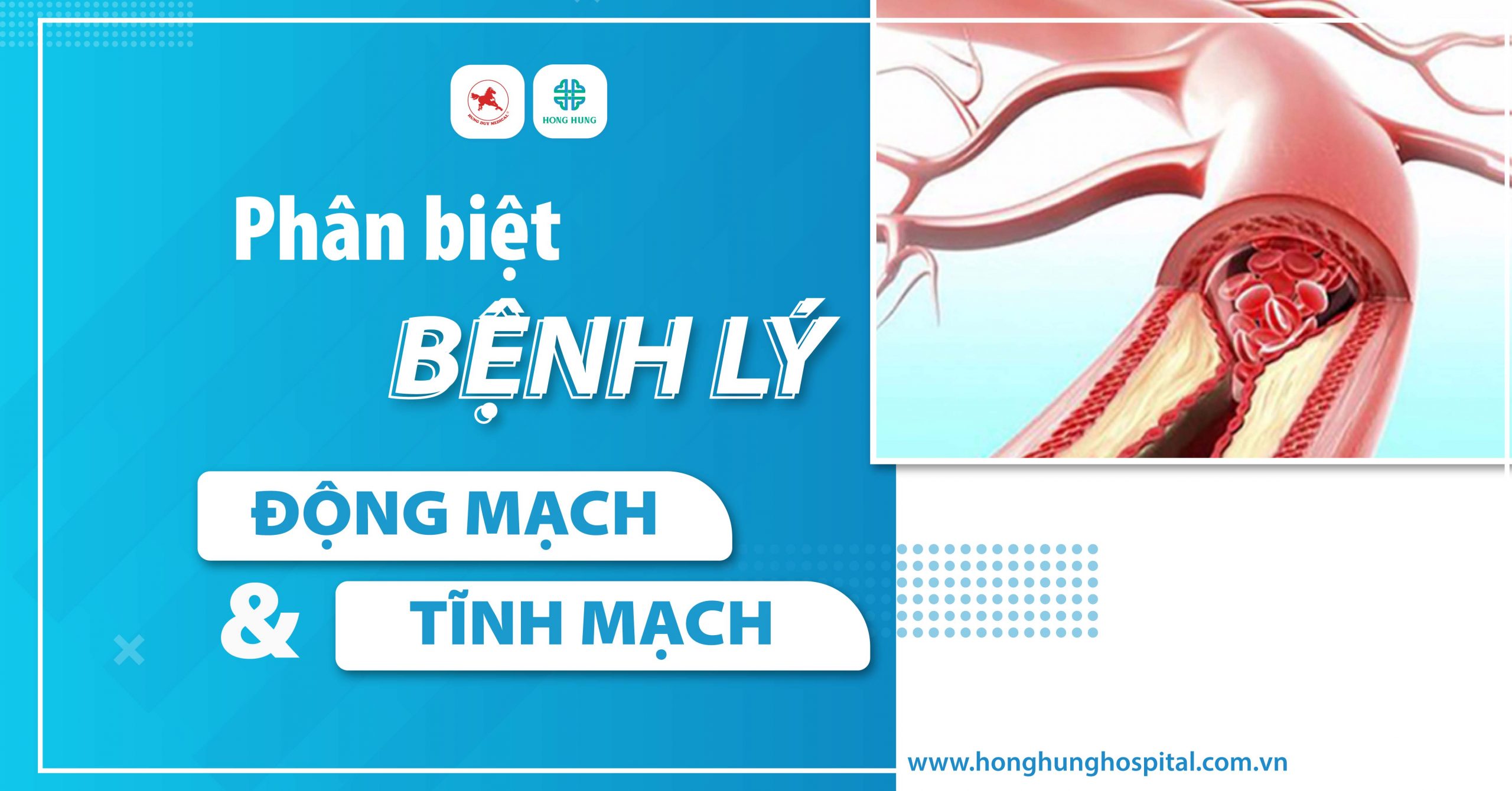 phan biet benh ly dong mach va tinh mach