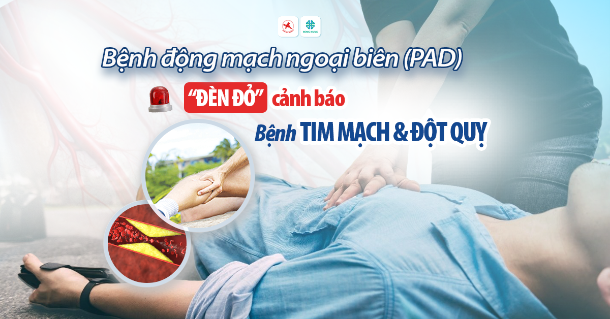 benh dong mach ngoai bien