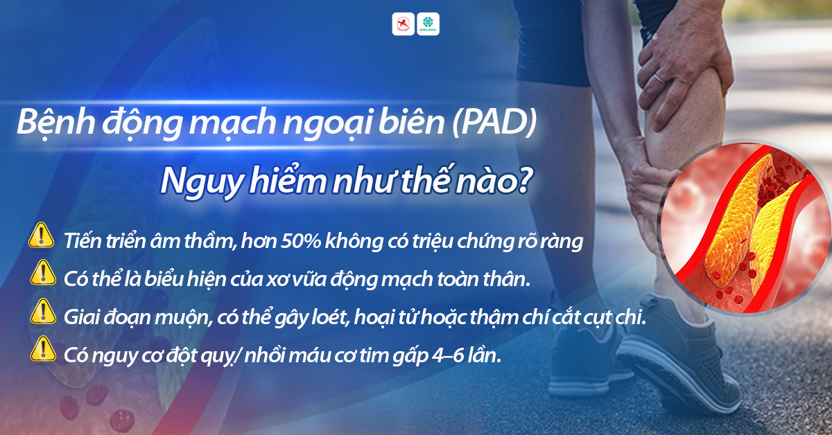 tvsk benh dong mach ngoai bien pad