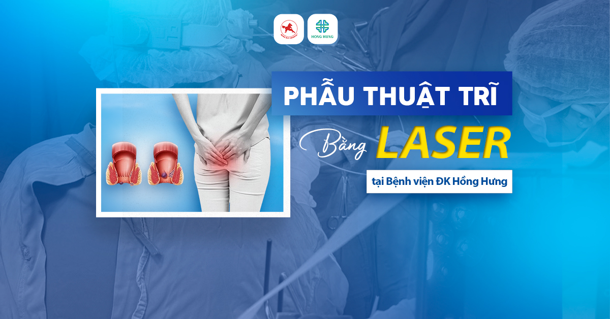 phau thuat tri bang laser