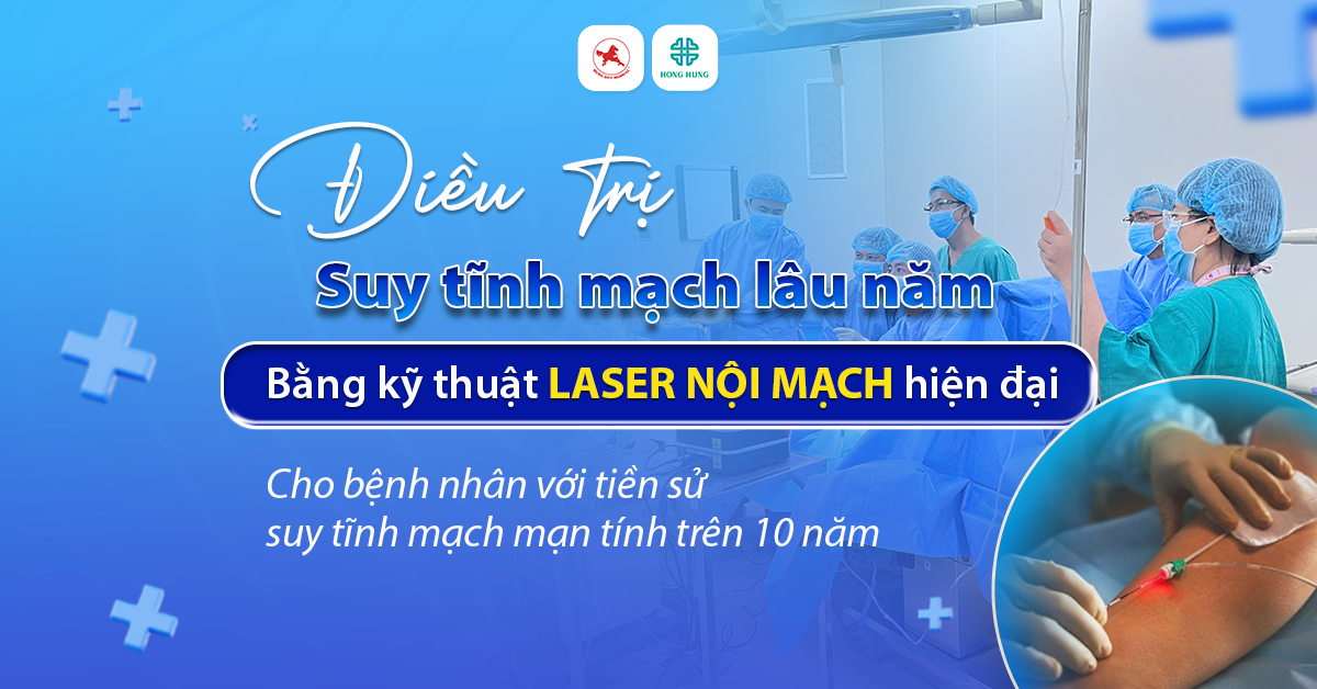 laser noi mach 