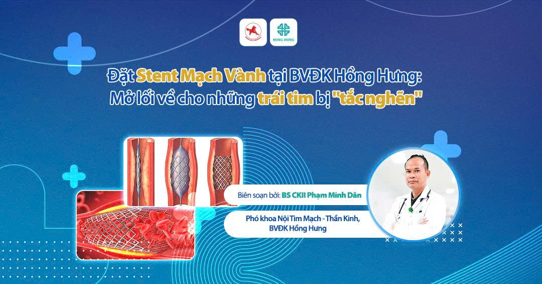 dat stent mach vanh