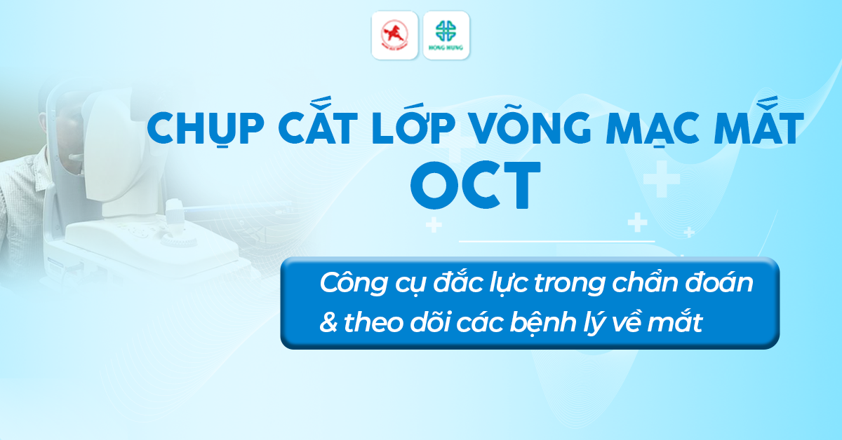 Ky thuat OCT 