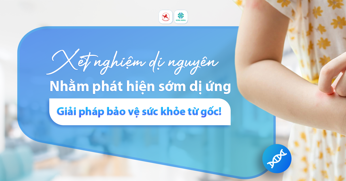 xet nghiem di nguyen