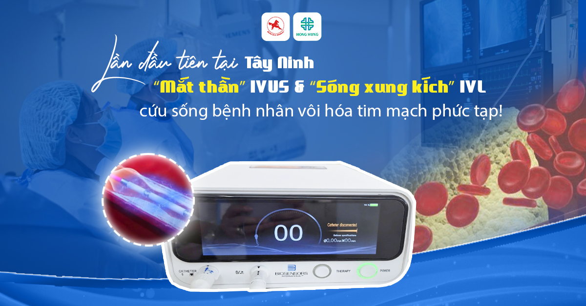 can thiep mach vanh phuc tap