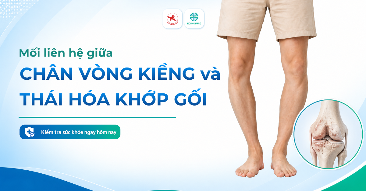 thoai hoa khop